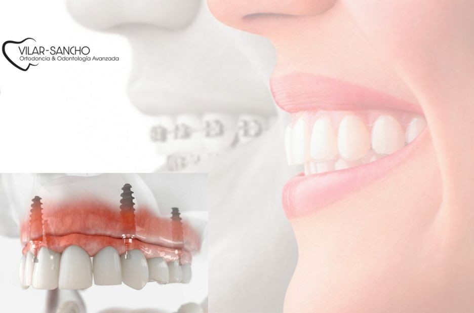 Clínica dental en Pozuelo de Alarcón: sonrisa saludable y profesionalidad