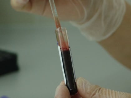 Учеников СОШ № 19 и их родителей отправили на сдачу анализов на туберкулез в Дальнем