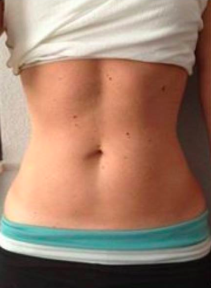 After Transformation