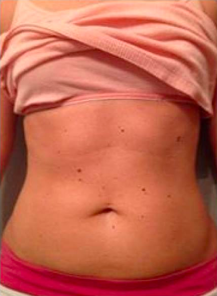 Before Transformation