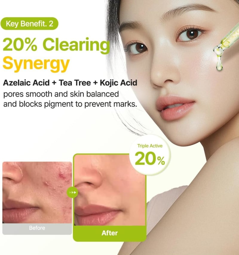 PURITO Seoul Azelaic Acid 10 Kojic Tea Tree Serum 30 ml | 10% Azelaic Acid, 10% Tea Tree & 1,000 ppm Kojic Acid | Blemish, Post-Acne Mark & Uneven Tone Care 5