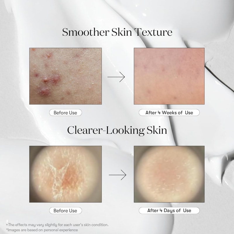 VT COSMETICS Reedle Shot 100 30 ml | CICA REEDLE™ Micro-Spicule Skin Booster | Texture, Pores & Radiance Care | Korean Skincare 6