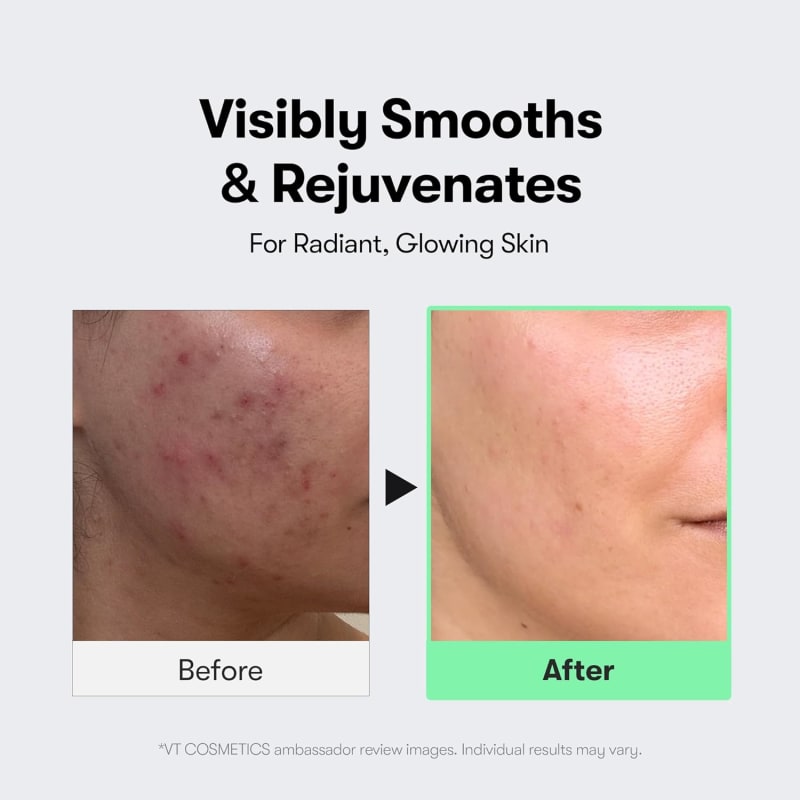 VT COSMETICS Reedle Shot 300 | CICA REEDLE™ Advanced Skin Booster | 237,500 Micro-Spicules | Texture, Pores & Uneven Tone Care 3