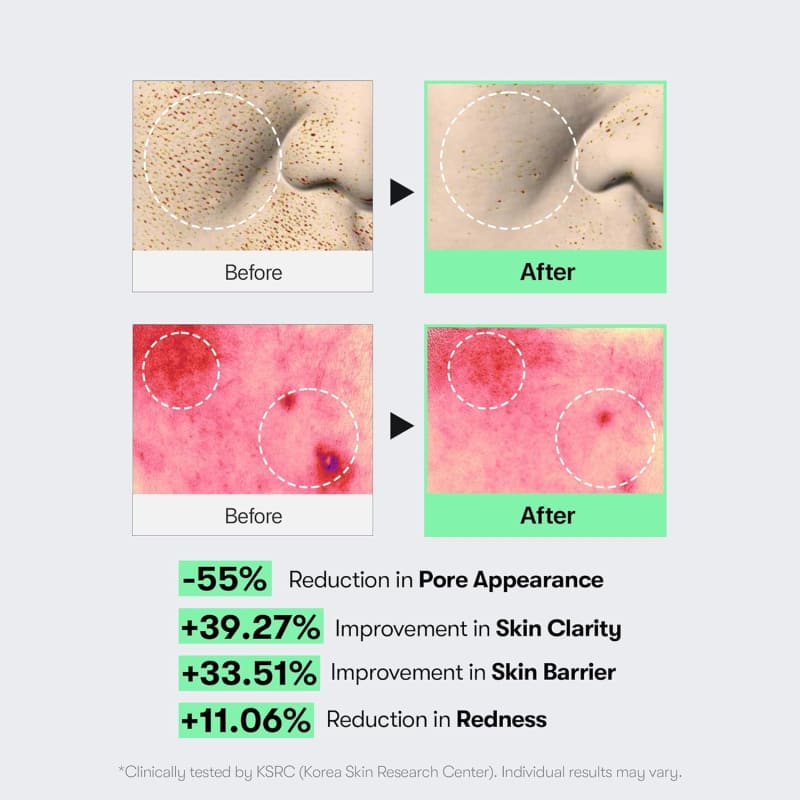 VT COSMETICS Reedle Shot 100 50 ml | CICA REEDLE™ Micro-Spicule Skin Booster | Texture, Pores & Radiance Care | Korean Skincare 2
