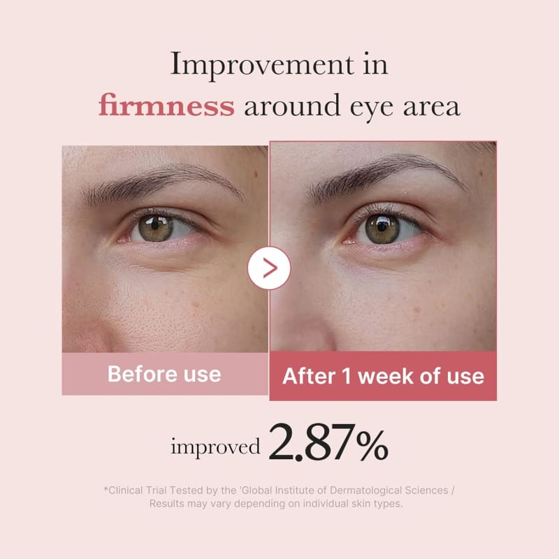 Medicube PDRN Pink Peptide Eye Serum 30ml | Salmon DNA PDRN + 5% Niacinamide + Peptides | Brightening & Firming Eye Care 5