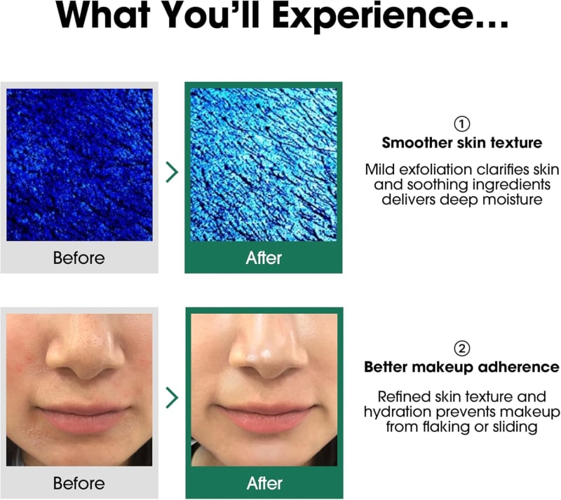 Some By Mi AHA BHA PHA 30 Days Miracle Toner 2