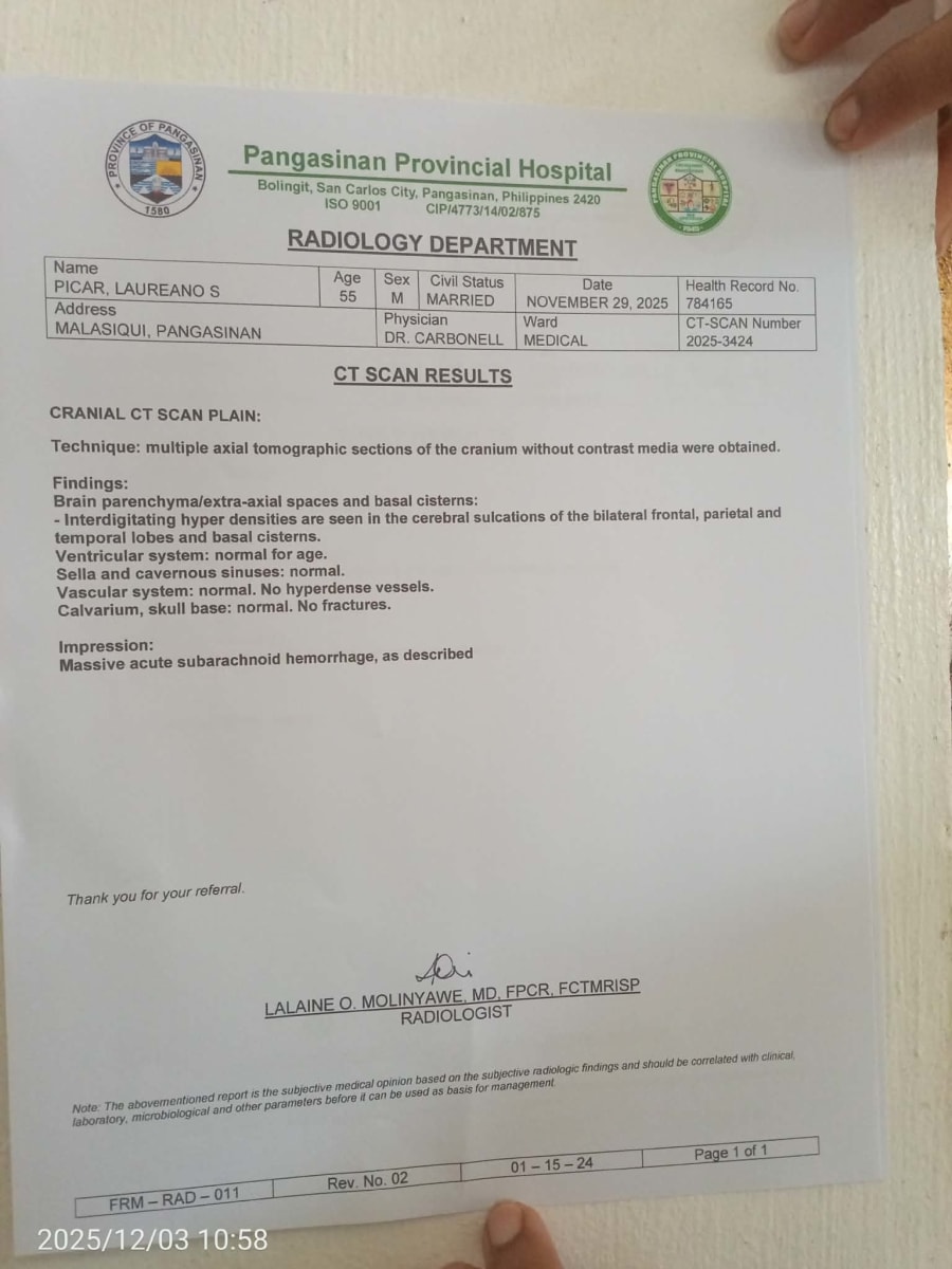 TULONG PARA SA TATAY KONG MAY BRAIN BLEED(Emergency Craniotomy Fund)  - Image 4