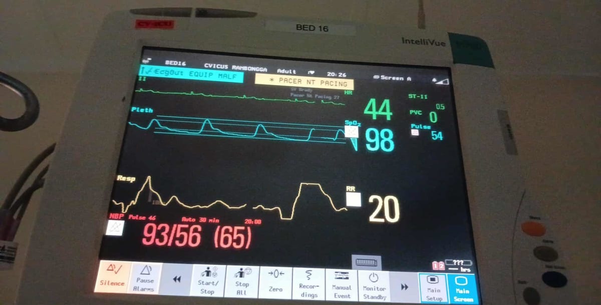 Help Cover Costs for a Second Angioplasty Procedure - Image 1