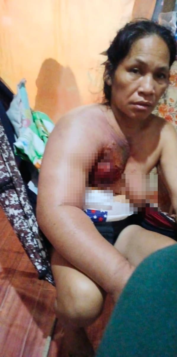 Help Me Save the Life of a Beautiful Filipina Aunt - Image 4