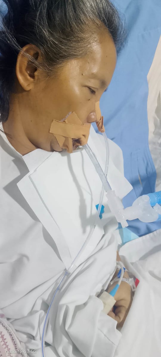 Help My Mother Get a Life-Saving Tracheostomy - Image 2