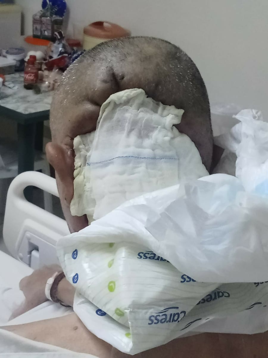 Help Noel Beat This Infection: Support His Medical Recovery - Image 1