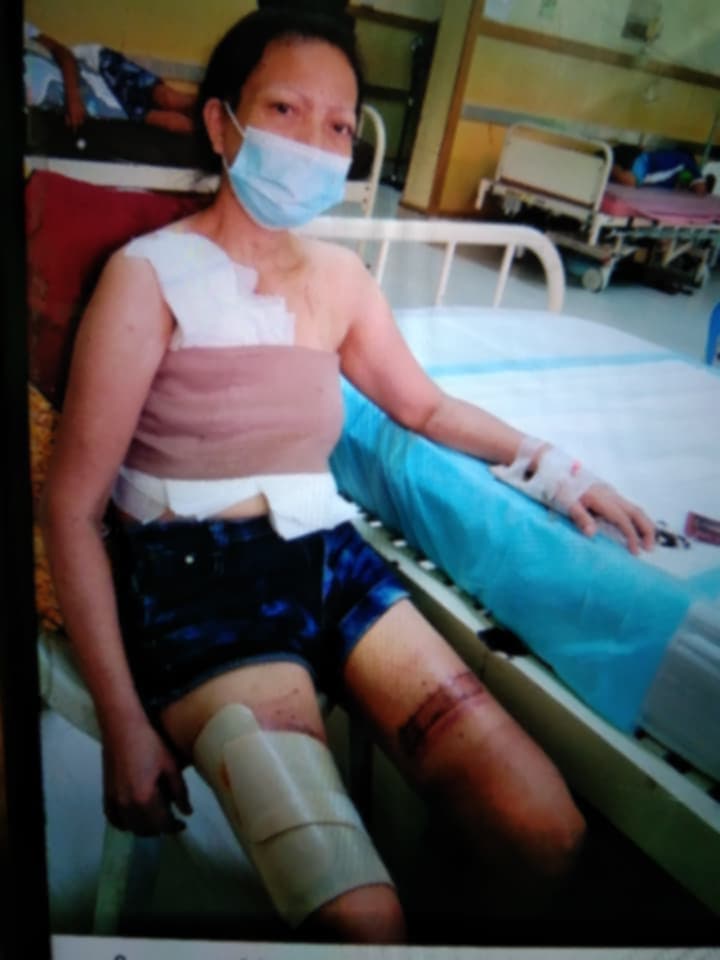 ❤️ Help Our Friend, Marilou Candelaria, Rebuild Her Life After Breast Cancer - Image 1