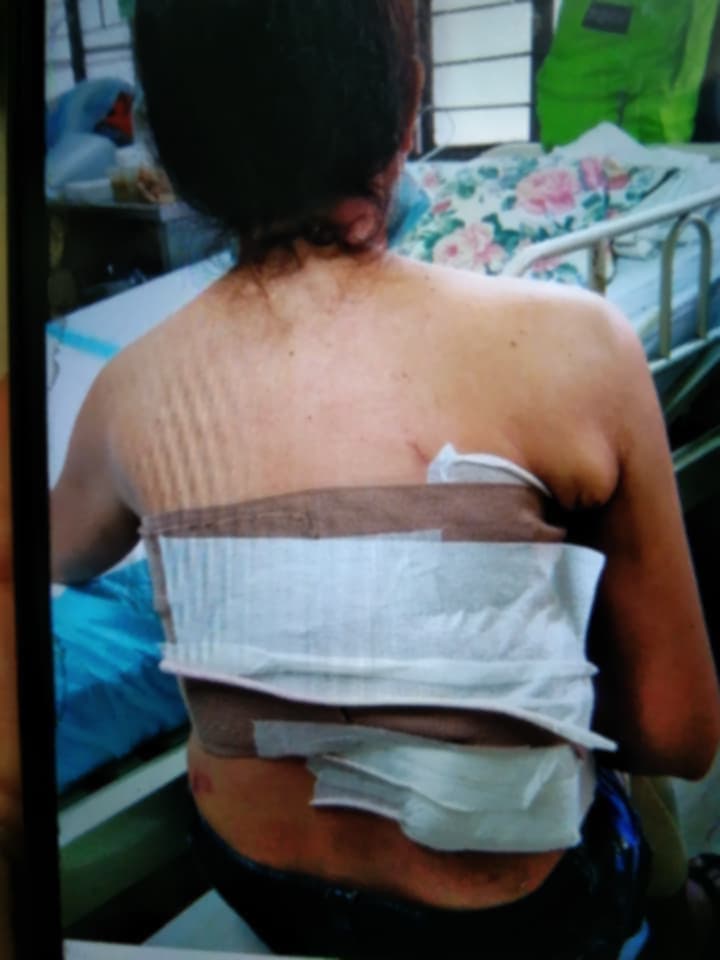 ❤️ Help Our Friend, Marilou Candelaria, Rebuild Her Life After Breast Cancer - Image 3