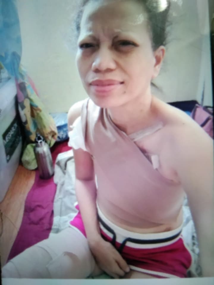 ❤️ Help Our Friend, Marilou Candelaria, Rebuild Her Life After Breast Cancer - Image 4