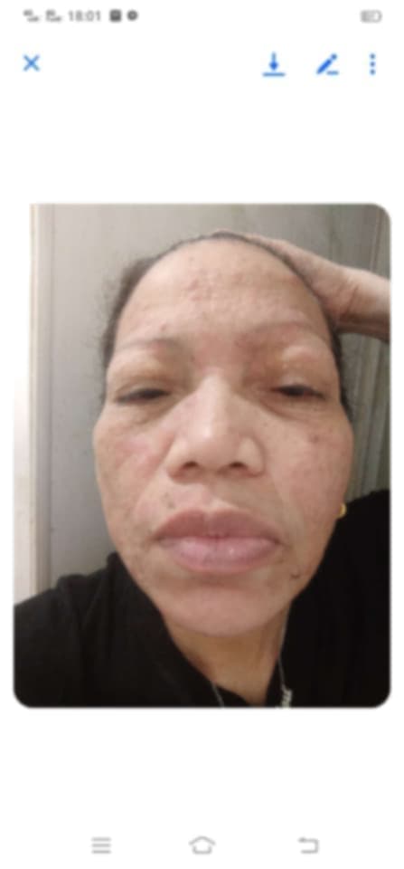 ❤️ Help Our Friend, Marilou Candelaria, Rebuild Her Life After Breast Cancer - Image 5