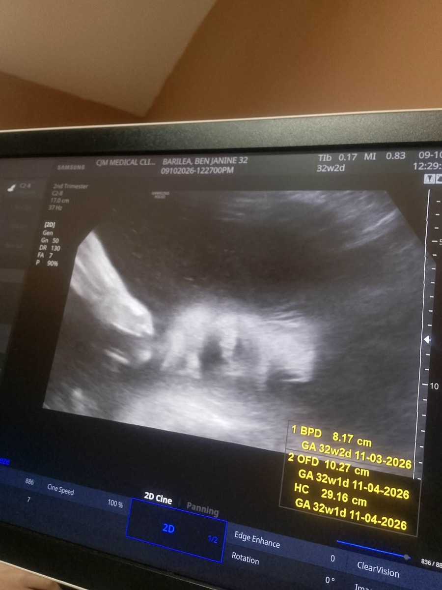 The Story of Hope for Baby and Her Brave Single Mom - Image 3