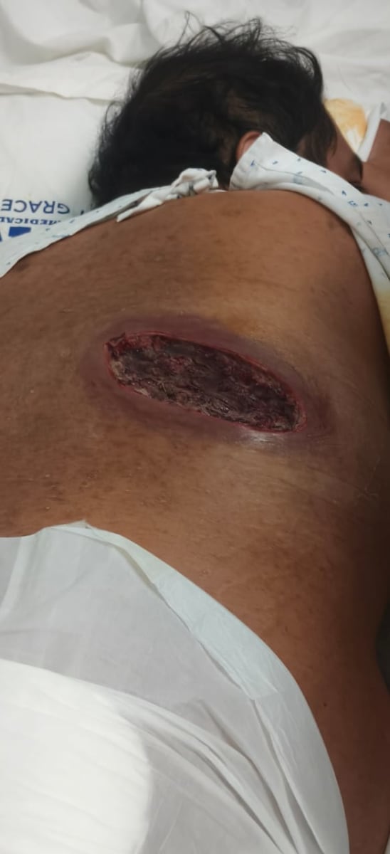 Help Jazon with his hospital bills and medication - Image 2