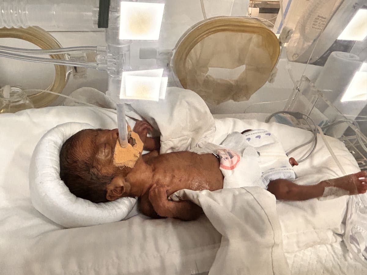 Help Baby Kenan Survive 25-Week Extreme Prematurity in the NICU - Image 1