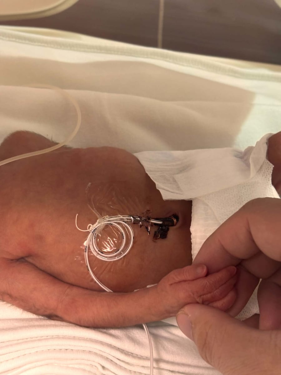 Two Hearts, One Fight: Ann & Baby Adam - Image 1