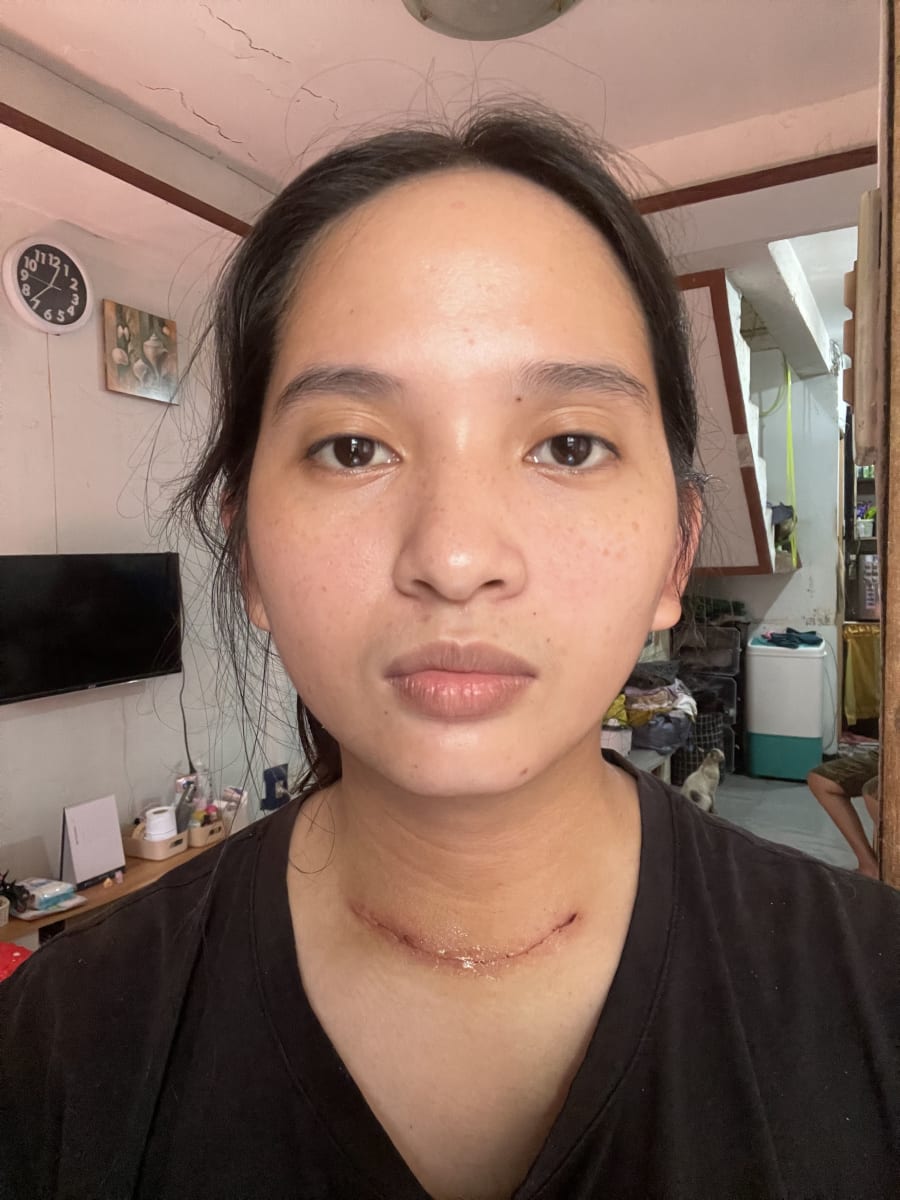 HELP ME COMPLETE MY THYROID CANCER TREATMENT 🙏 - Image 1