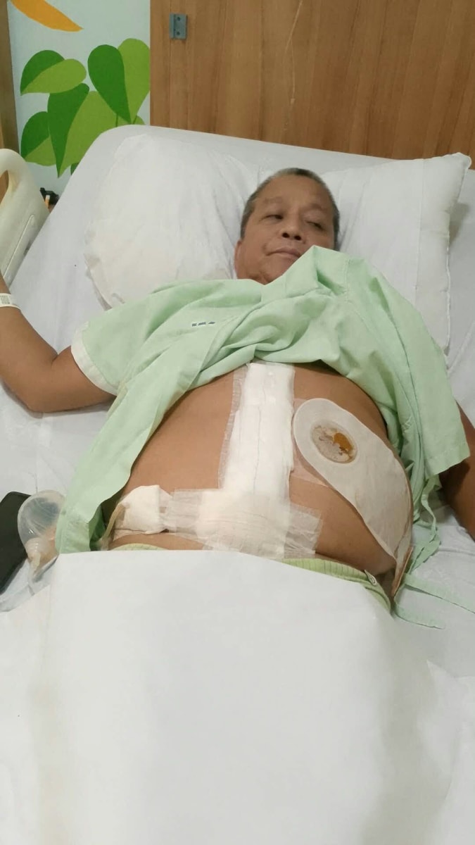 Critical Medical Fund for Anthony’s Second Surgery - Image 1