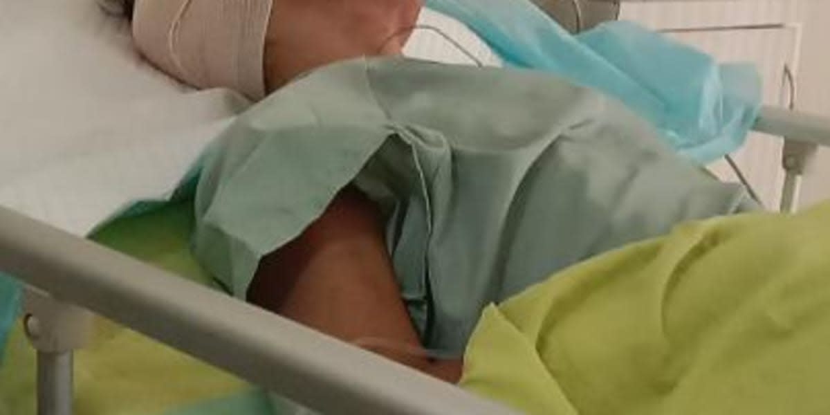 Aneurysm Suergery