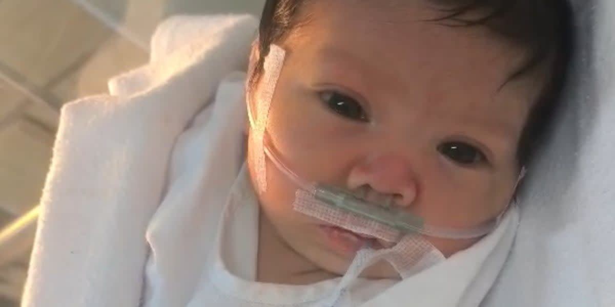 Medical Fund for Our Baby with Campomelic Dysplasia