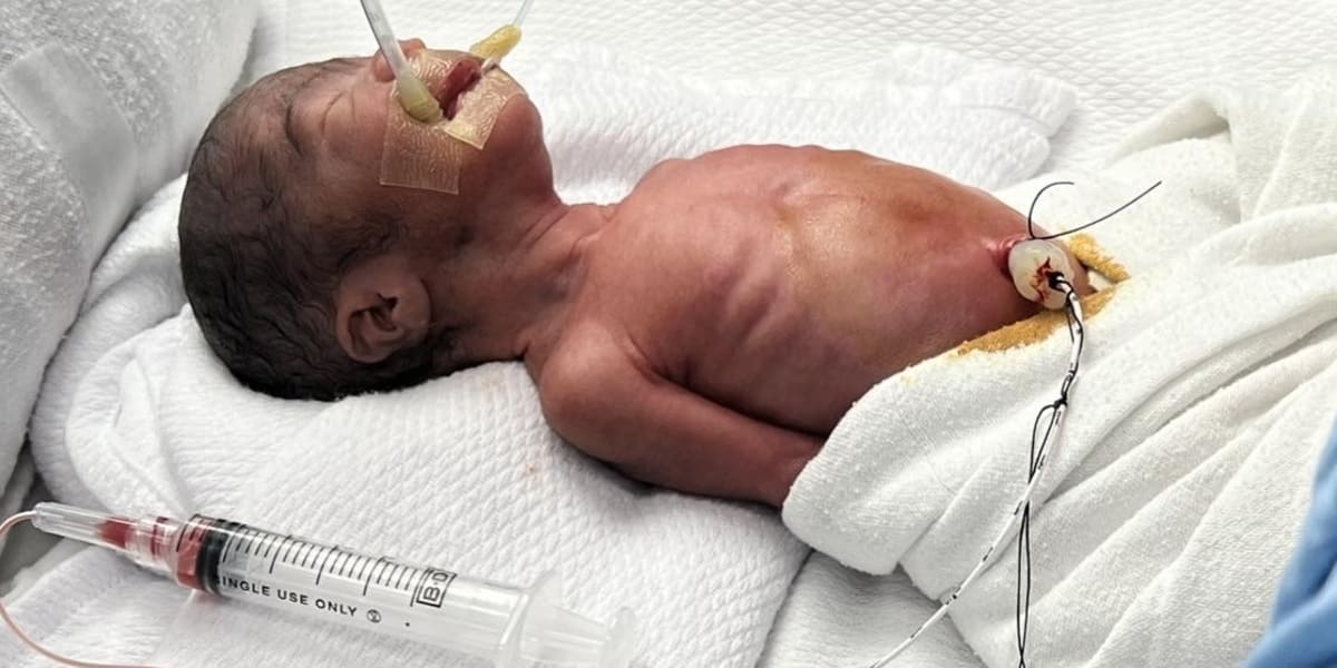 Help Us Settle Our Baby’s Remaining NICU Hospital Bil
