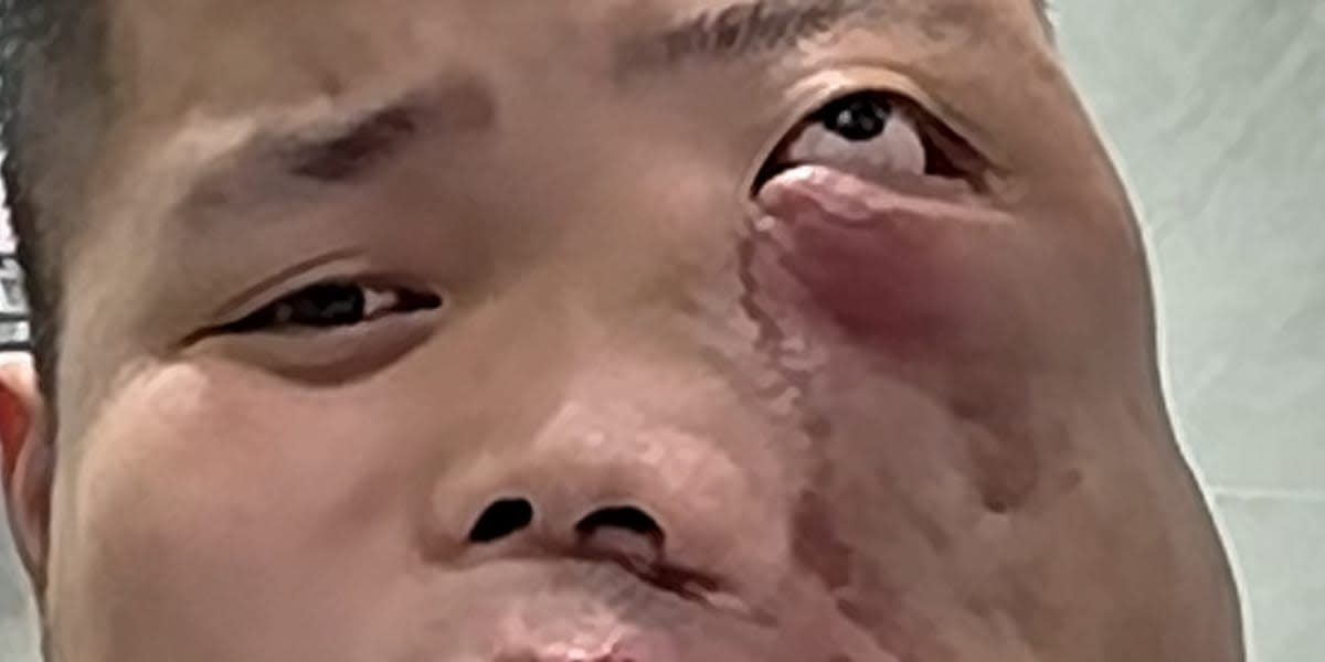 face surgery for this guy