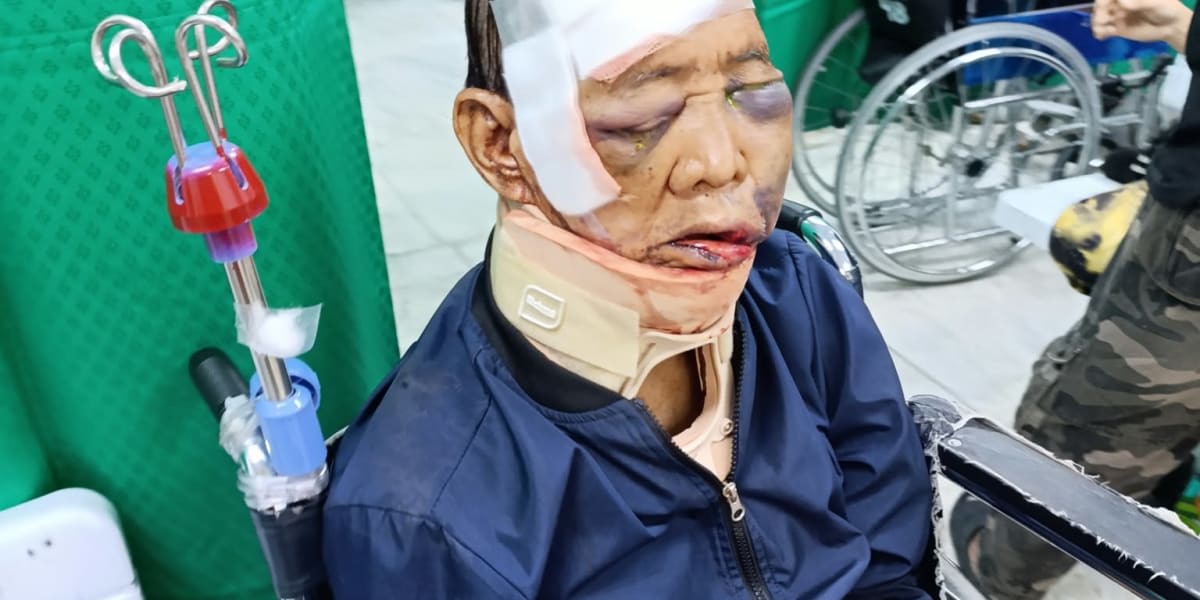 Help 74-Year-Old Man Hit by a Motorcycle While Crossing the Street