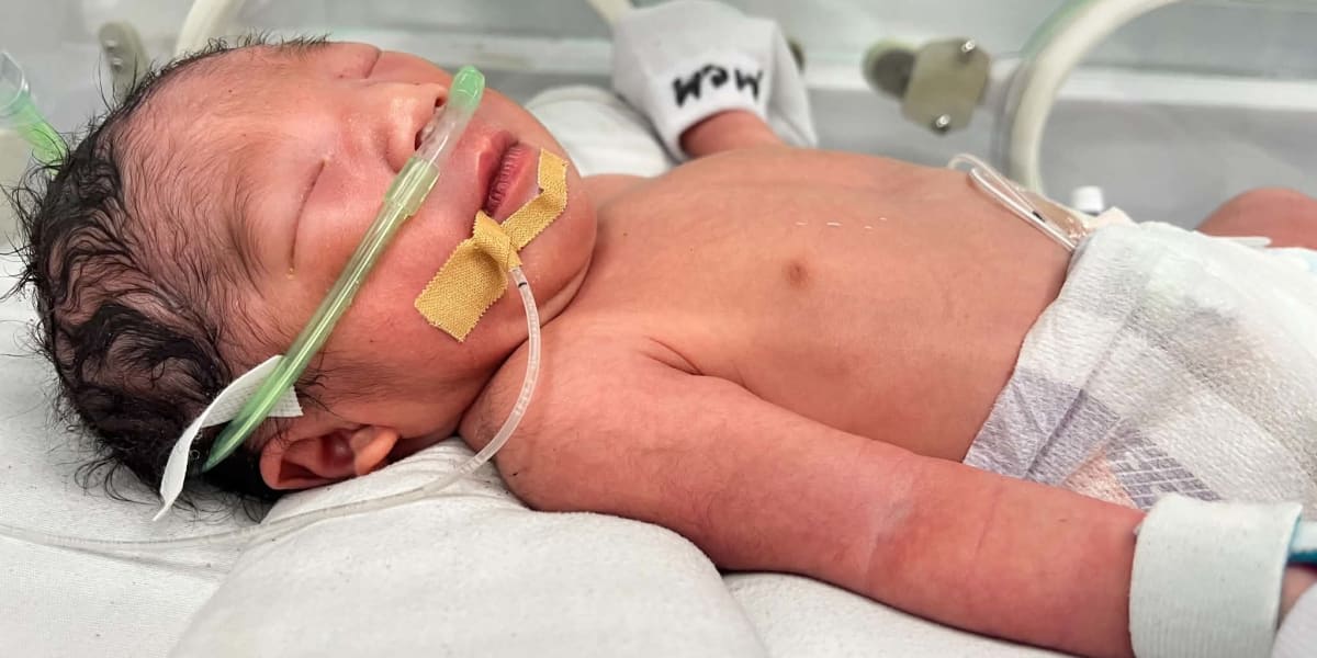 HELP OUR LITTLE CALIX TO FIGHT HIS LIFE IN NICU