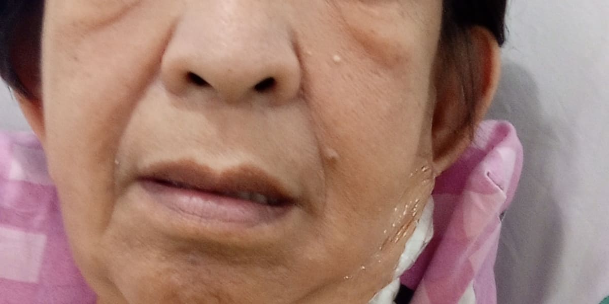 Help me for my medical needs