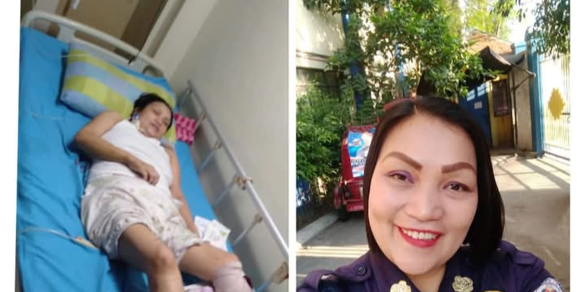 Help me to have my own prosthetic leg. I'm a leg foot amputee