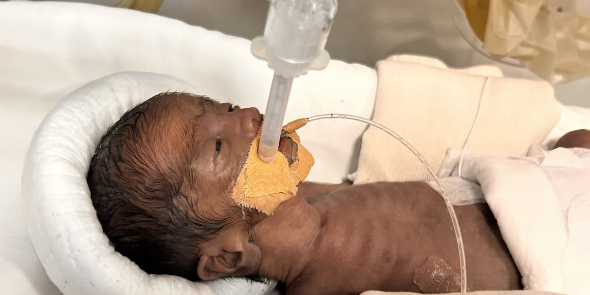 Help Baby Kenan Survive 25-Week Extreme Prematurity in the NICU