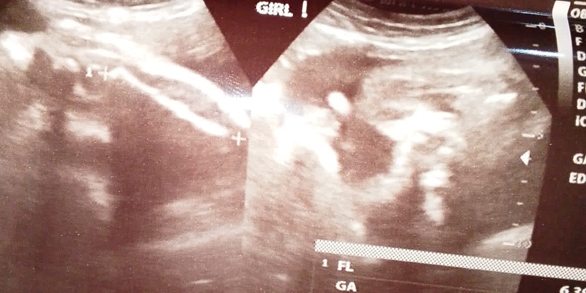 Help Me Complete Essentials for My Second Baby Girl Due This August