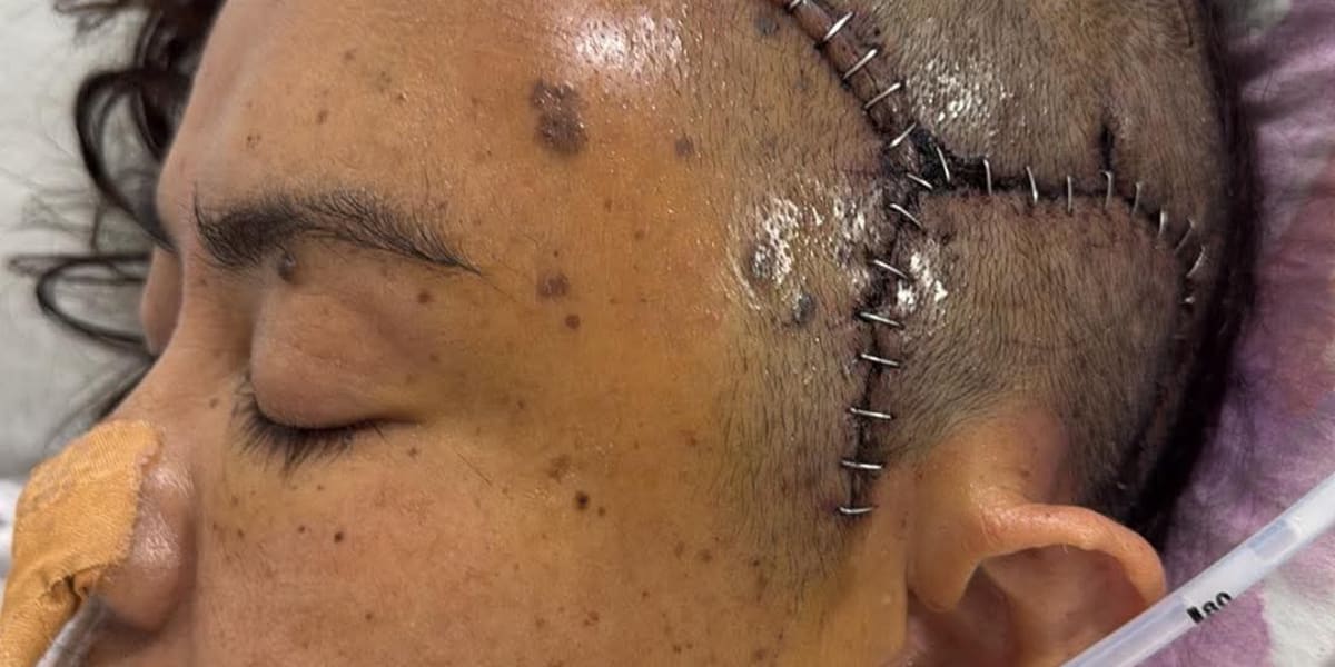     Two Brain Surgeries. One Hope. Help Ana Maria.
