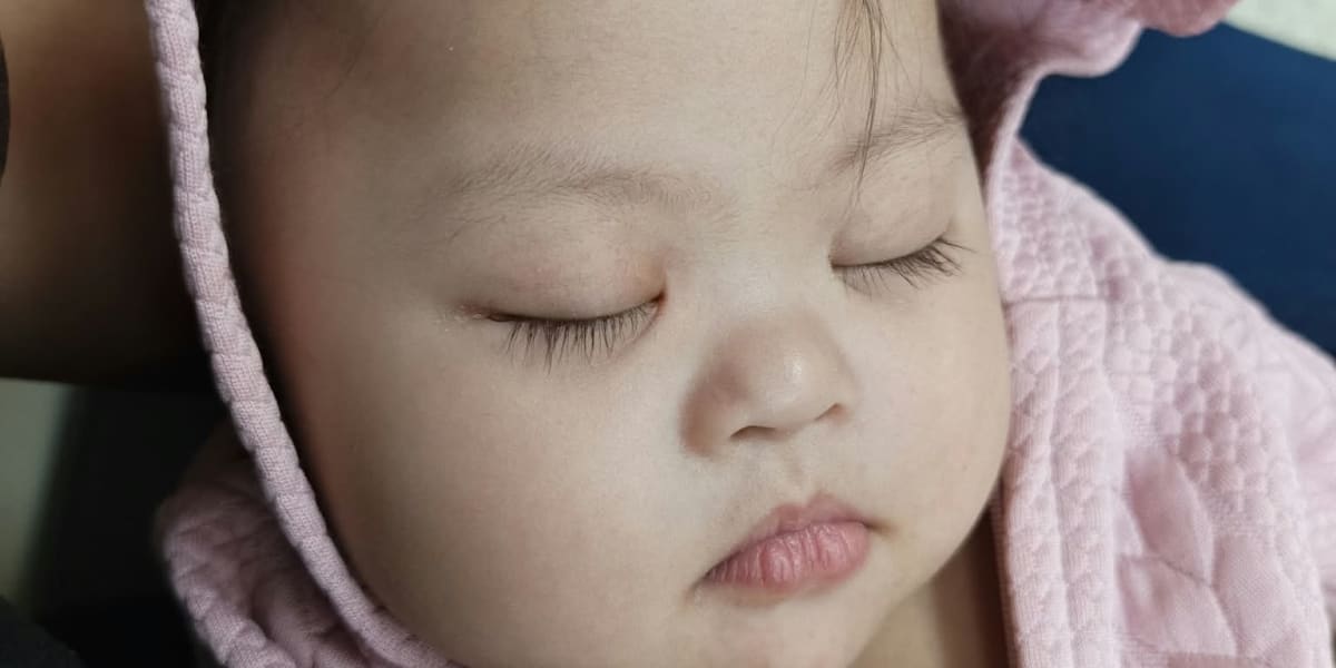 Baby Samantha operation