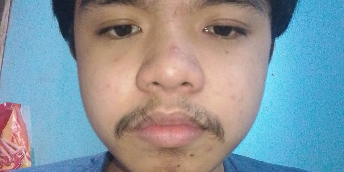 Hello everyone, my name is Denver Quilas, i need an assistance for a physical therapy session 