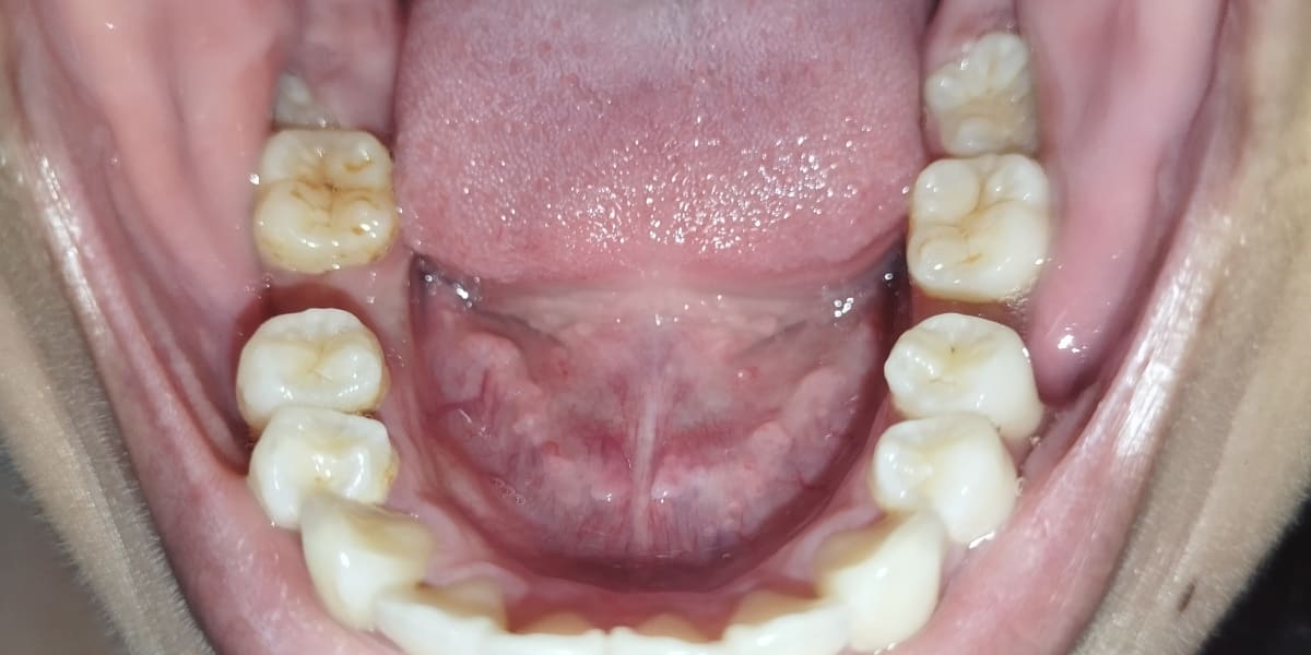 🥺 Sakit ng Ngipin, Sakit sa Bulsa: Student Dental Appeal