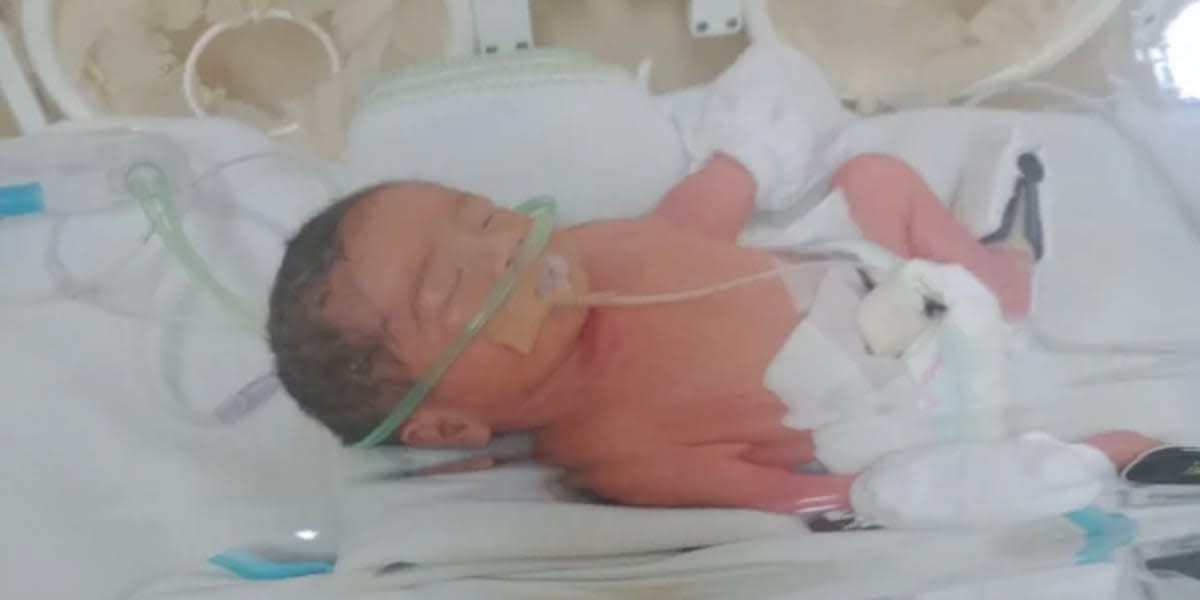Help my preemie baby boy 