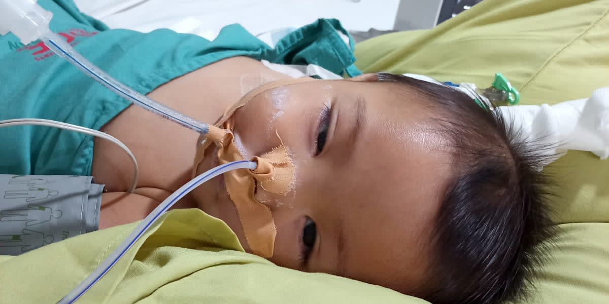 NEED HELP for a 7 month old NICOMACHUS who is admitted in PICU due to Acute Kidney Injury