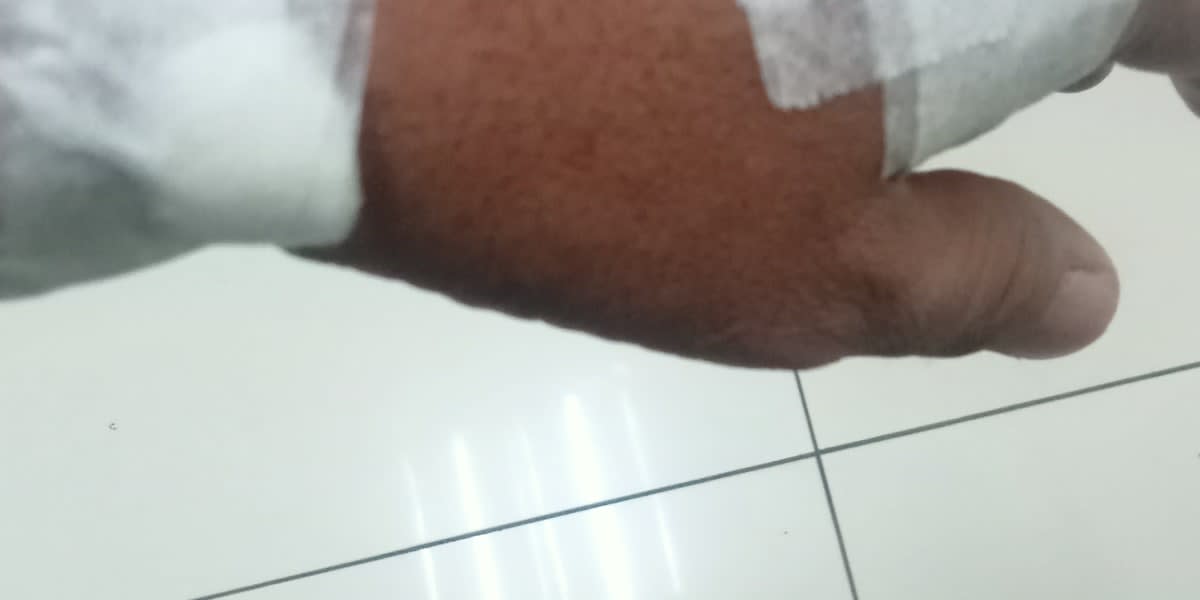 Help for my medication for my type2 diabetics ang ganglion cyst.