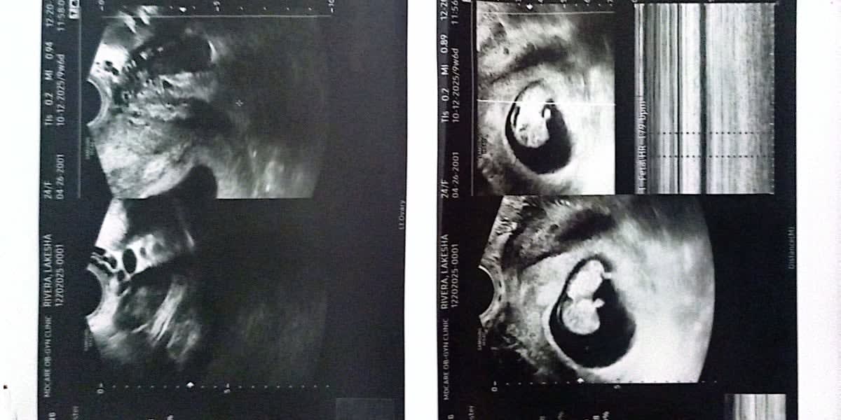 Emergency Fund for Safe Delivery of Our Baby