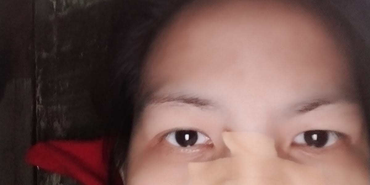 Give Kate a chance to live 