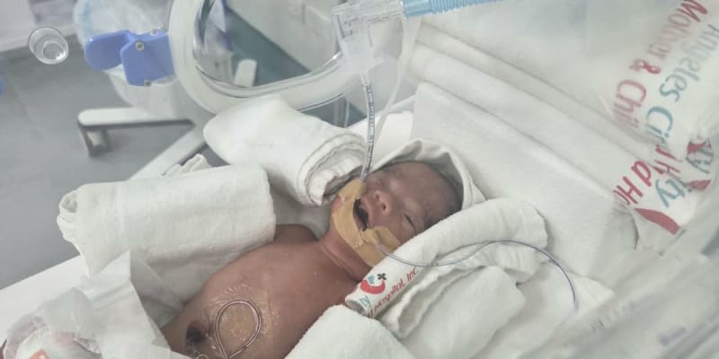 Help Baby Matheo Gabriel Fight for His Life in the NICU