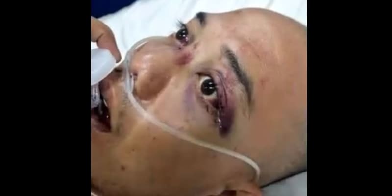 Urgent Medical Support: Spinal Surgery Fund for Delmar