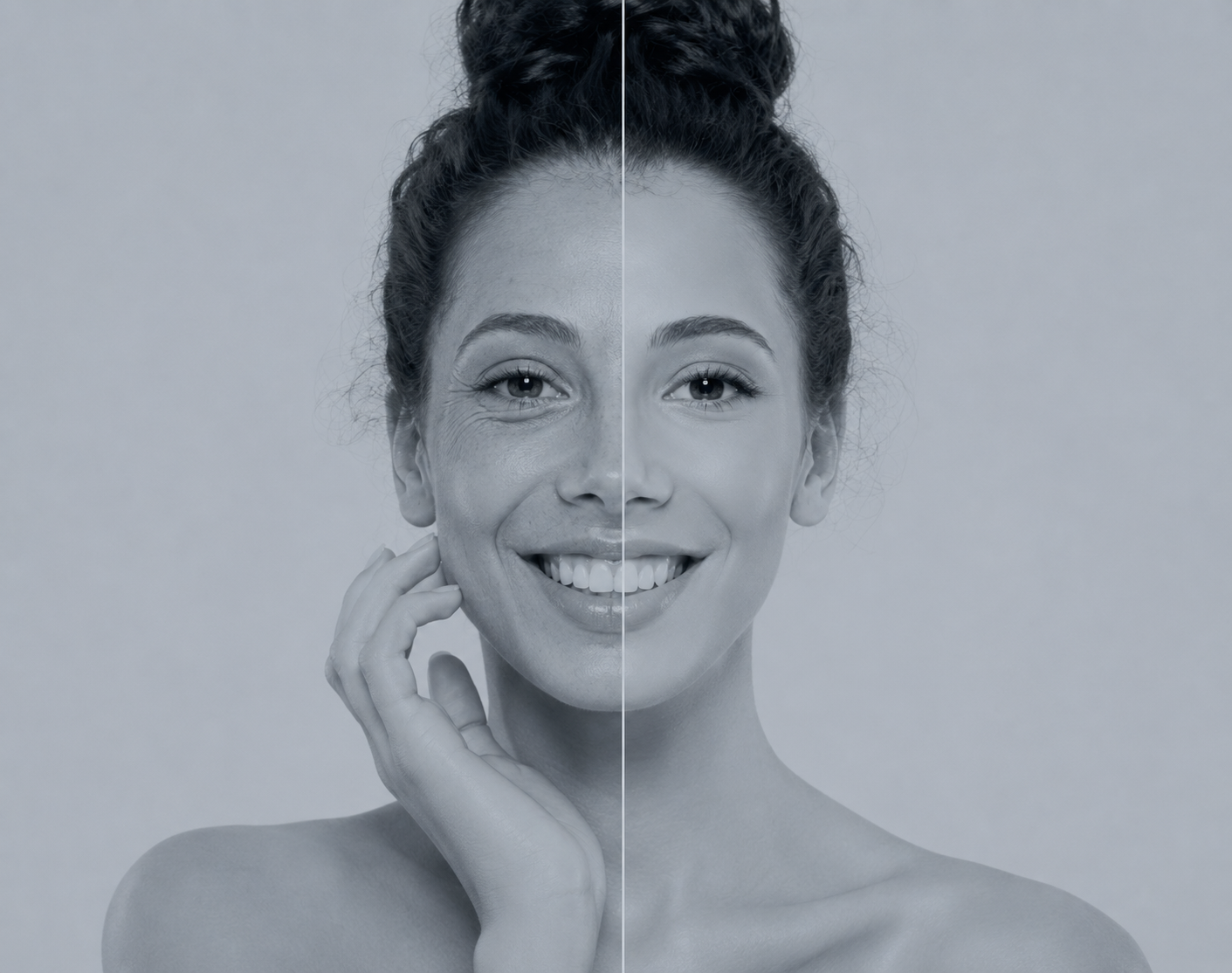 Rejuvenecimiento Facial