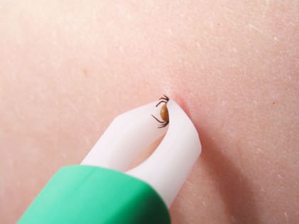 Нерюнгринский район оказался в тройке лидеров по количеству случаев укусов клещами