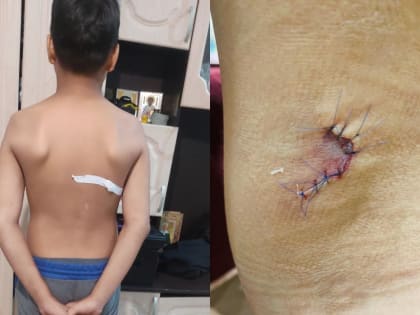 В Якутске ребенок получил травму на детской площадке