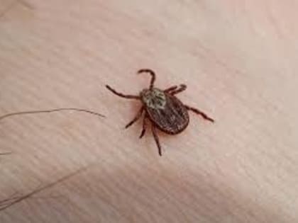 Клещи пришли в города: Зарегистрированы укусы опасных насекомых